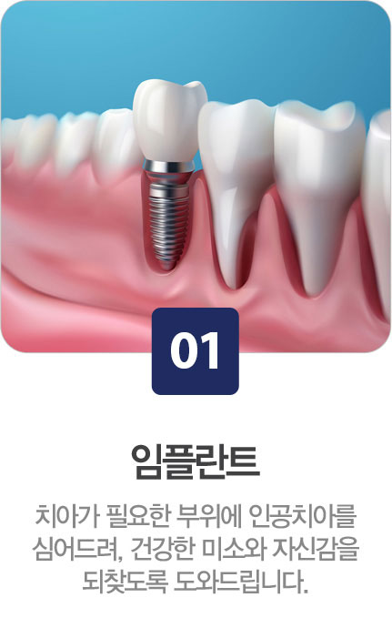 임플란트