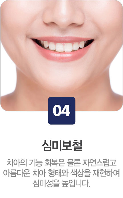 심미보철