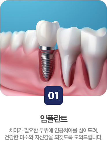 임플란트