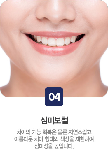 심미보철