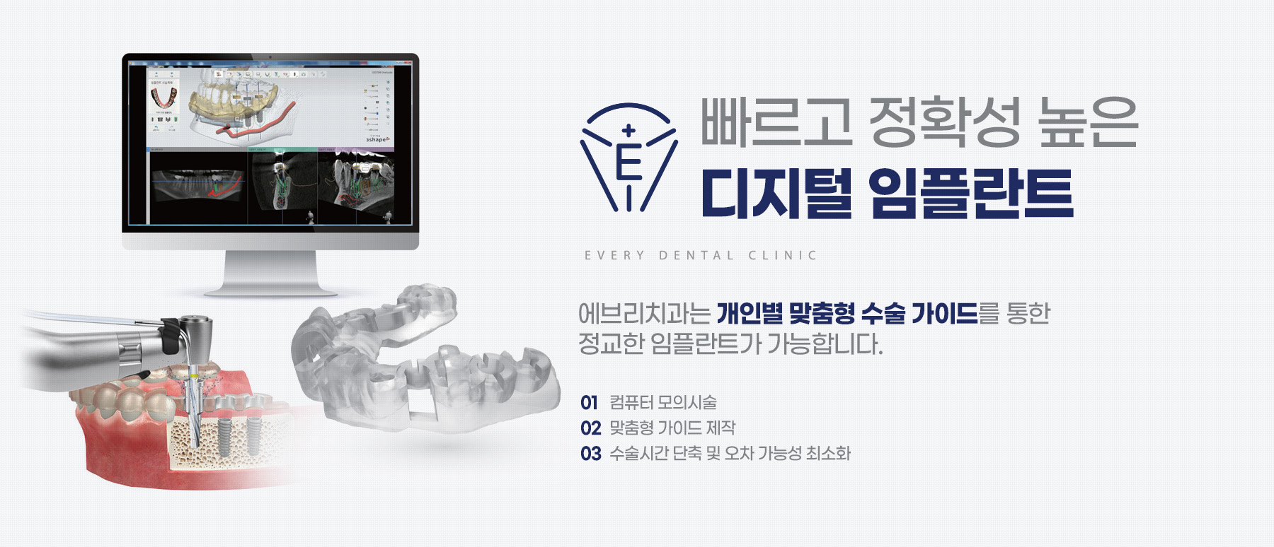 빠르고 정확성 높은 디지털 임플란트